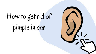 How to get rid of pimple in ear