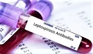 تحليل Leptospira