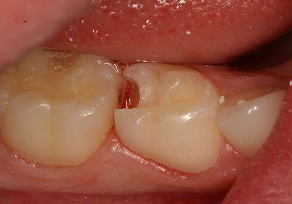 Rehabilitación Oral