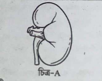 গ্লোমেরুলাস বলতে কী বোঝায়