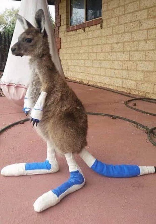 Young Kangaroo With Severe Burns Pleads For Water From A Boy