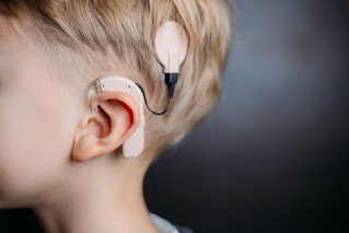 Cochlear Implants