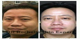 dr rochelle skin expert