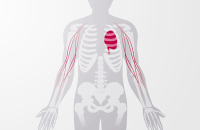 X-ray image of the body with cardiovascular system highlighted in red