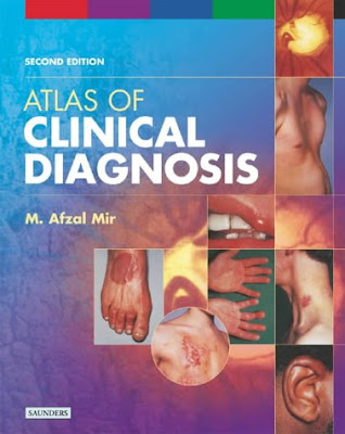 Atlas of Clinical Diagnosis 2nd Edition by M. Azfal Mir