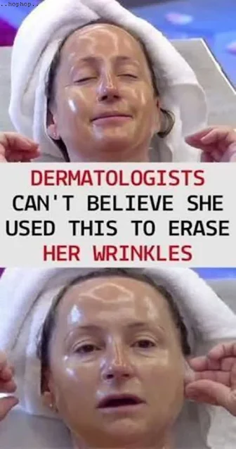 Dermatologists Can’t Believe She Used This To Erase Her Wrinkles