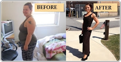 Weight loss success stories; Before and After Weight Loss Photo