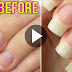 5 Ways To Grow Your Nails Very Fast!