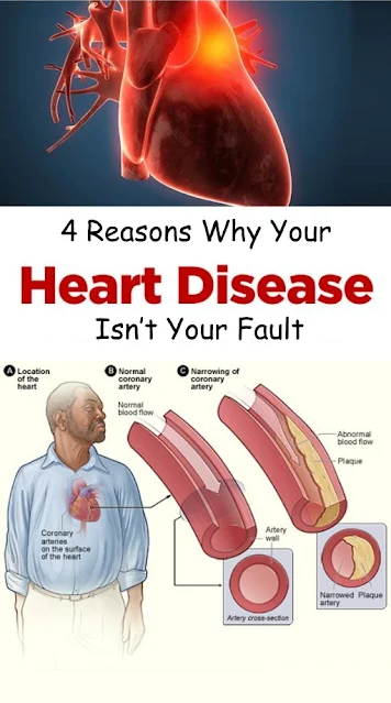 4 Reasons Why Your Heart Disease Isn’t Your Fault