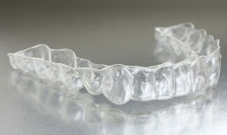 Giải pháp chỉnh nha tiên tiến: niềng răng invisalign