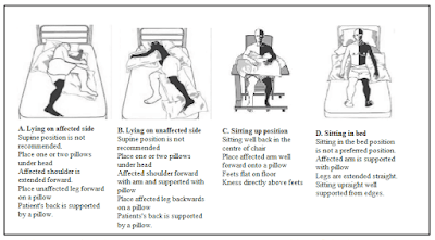 posisi tidur penderita stroke