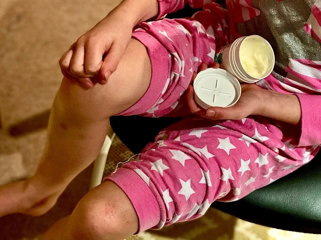 A child applying Epaderm Junior Ointment on to the eczema on her legs while wearing pyjamas