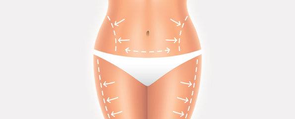 Liposuction in Hyderabad