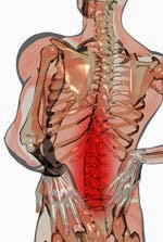 pinched nerve in lower back