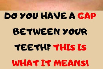 Do You Have A Gap Between Your Teeth? This Is What It Means!