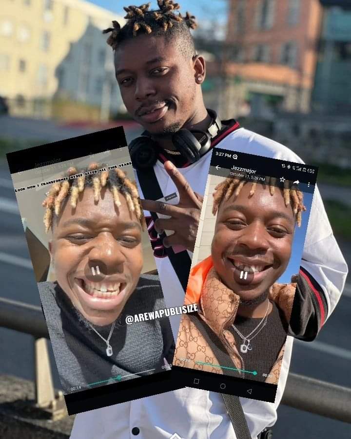 [Video] Viral video shows how popular music artist JezzMajor undergoes teeth sugery abroad He also has mind blowing musics on all online platforms ,dive into his music fams
