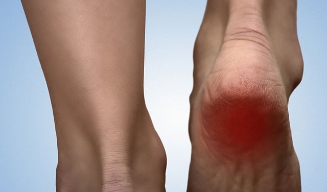 heel pain management ankle injury