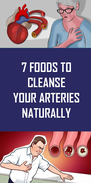 7 Foods to Cleanse Your Arteries Naturally