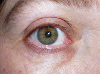 Visionwithoutglasses.comyr.com : Improve Vision Naturally   Some Helpful Tips