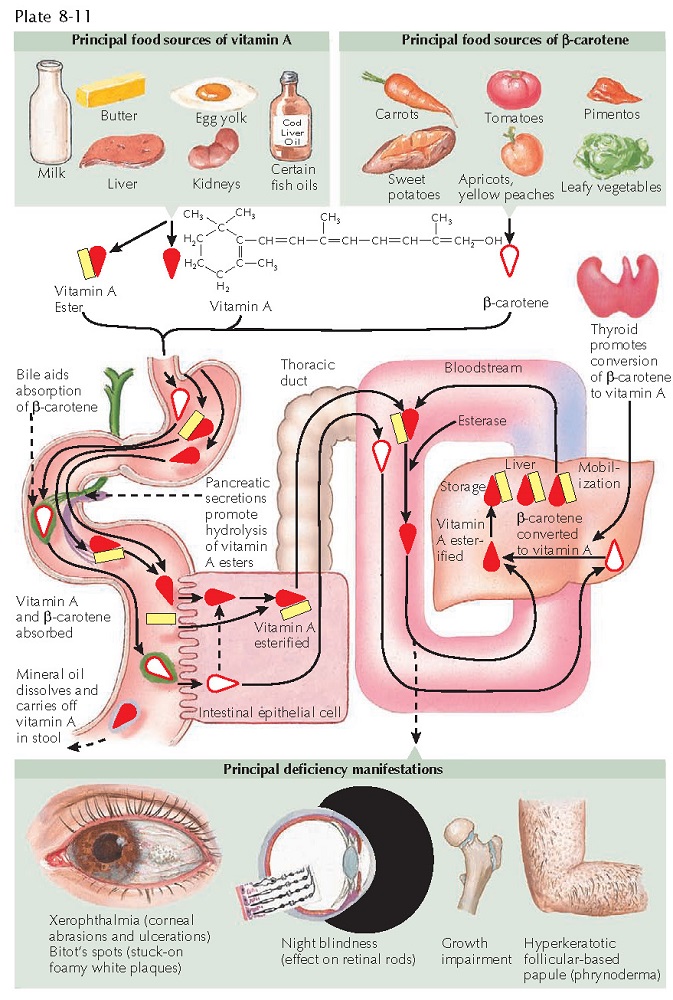 VITAMIN A DEFICIENCY