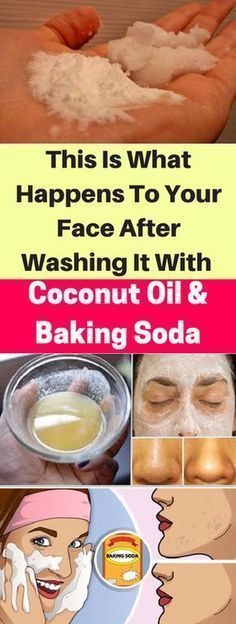 This Is What Happens To Your Face, After Washing & Coconut Oil & Baking Soda