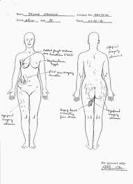 James Byrd Jr. autopsy photos Horror in Paris, Texas, another black man dragged to death. ... James Byrd, a 49-year-old black who was dragged to death on June 7 ... Dragging victim Brandon McClelland Photo courtesy, the McClelland family ... hate crime they say parallels the lynching of James Byrd Jr. in Jasper, Texas, ten years after James Byrd Jr. was dragged to death down a three mile stretch of country road simply because he was black, some things have