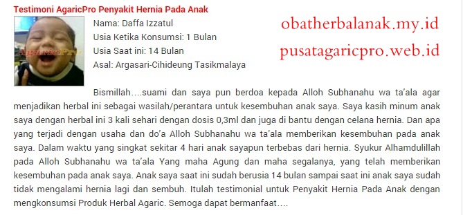 Cara Mengobati Hernia Pada Anak Tanpa Operasi ~ OBAT 