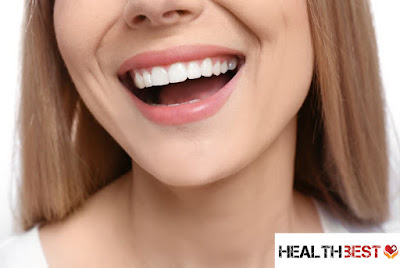 Hollywood smile dental