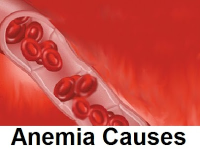 Information About Anemia Disease : How Is Anemia Caused, signs and symptoms, treatment in women and children | pernicious anaemia | what is types of anemia