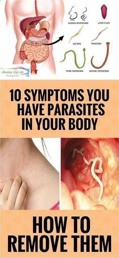 10 Symptoms You Have Parasites in Your Body and How to Remove Them