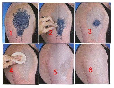 Tattoo Cover Up Techniques tattoo cover up ideas. Tattoo Cover Up Techniques