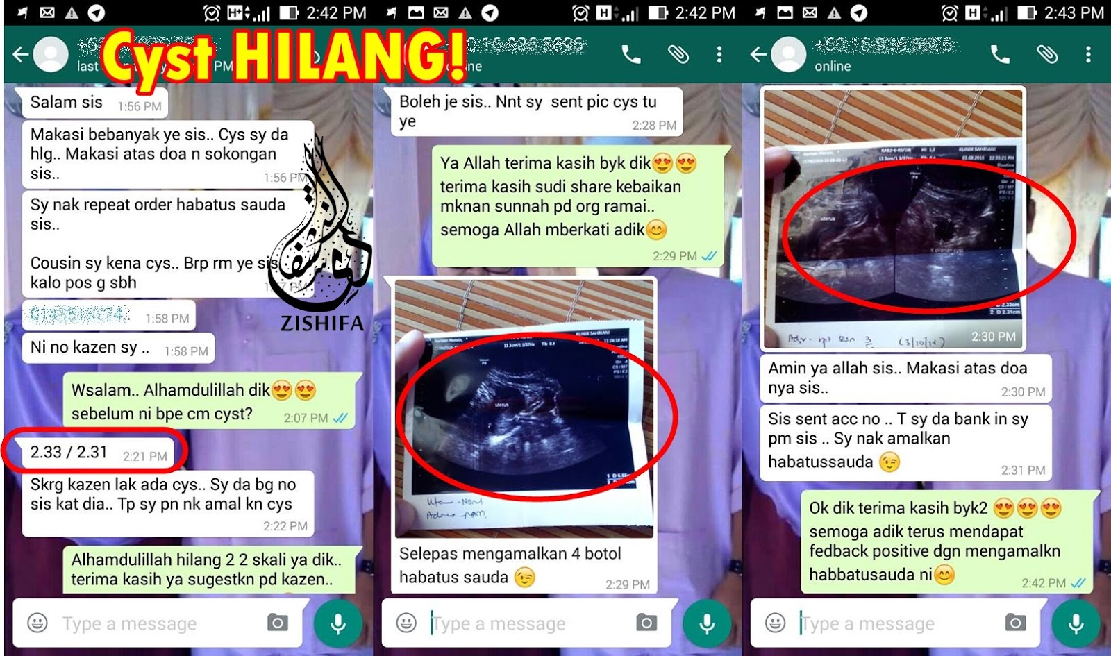 ZISHIFA: KETAHUI RAHSIA KECUTKAN CYST & FIBROID TANPA ...