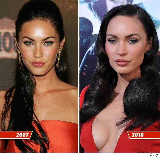 megan fox before after surgery. house after. megan fox surgery