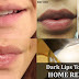 Dark Lips To Pink Lips Naturally - How To Get Pink Lips With This Home Remedy