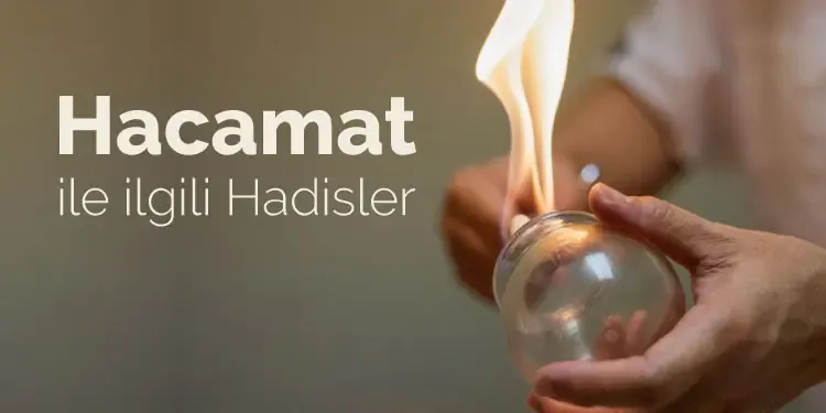 Hacamat Nedir? Hacamat İle İlgili Hadisler