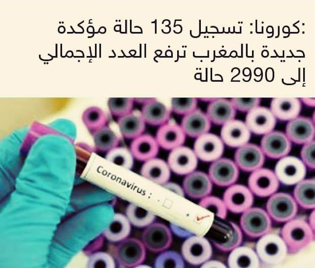 كورونا المغرب : تسجيل 135 حالة مؤكدة جديدة ترفع العدد الإجمالي إلى 2990 حالة