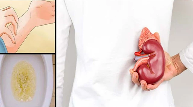 A Damaged Kidney Makes You Sick And Unhealthy