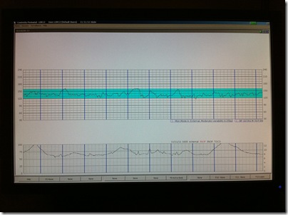 Contractions