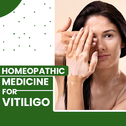 Homeopathic treatment for vitiligo