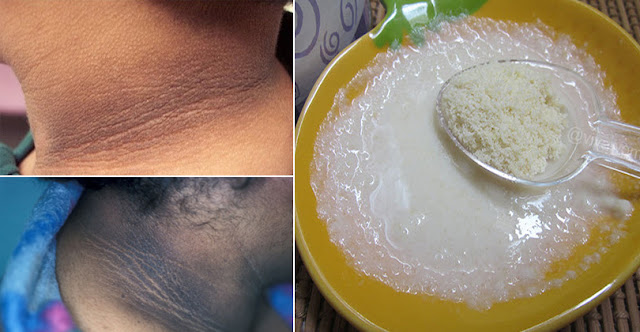 How To Whiten Dark Neck Within 20 Minutes At Home