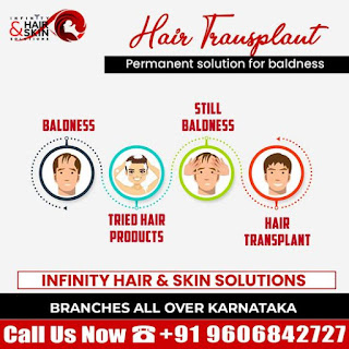 Hair Transplant