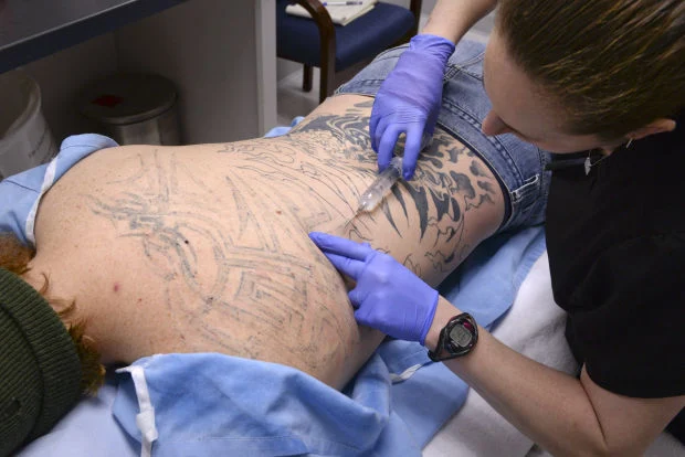 laser tattoo removal that 6 wrong things to avoid