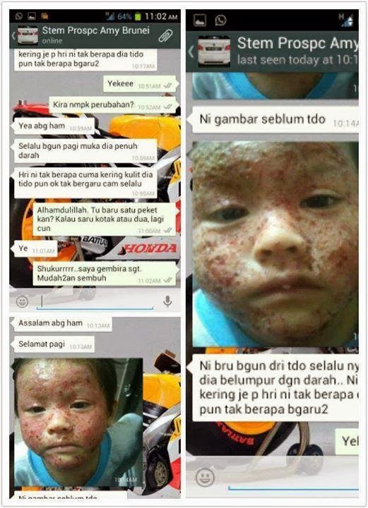 Phyto Science Stem Cell: Testimoni Double Stem Cell