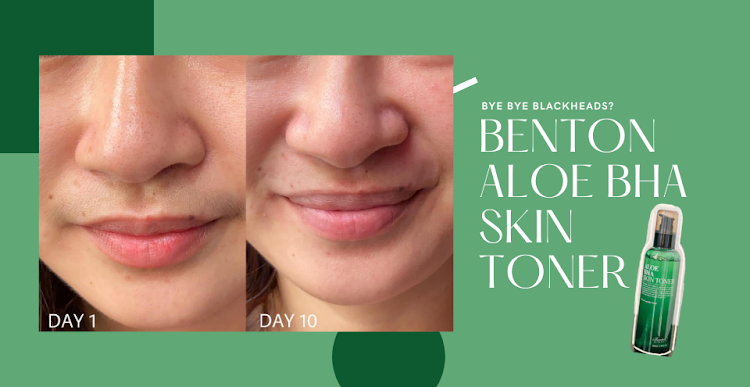 Skincare Test: Benton Aloe BHA Skin Toner