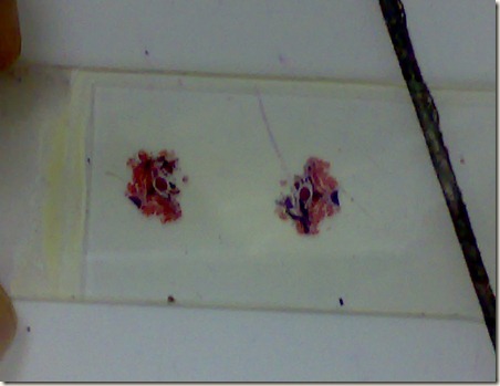 Hyaline cartilage -gross view on glass slide-staining
