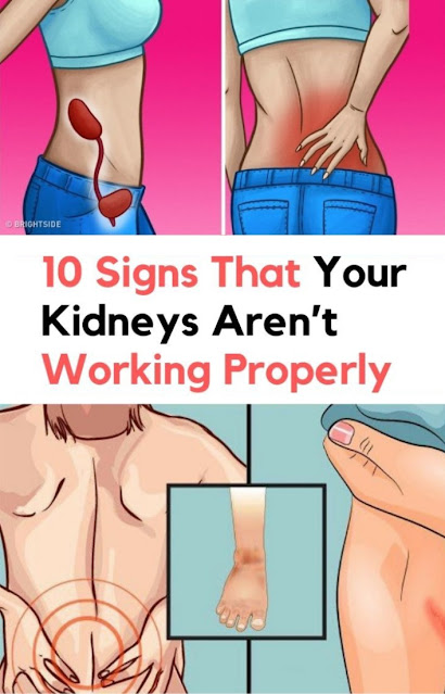 Signs That Your Kidneys Are Not Working Properly !