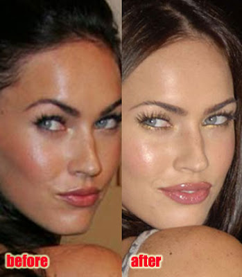 megan fox before surgery pictures. Megan Fox Plastic Surgery