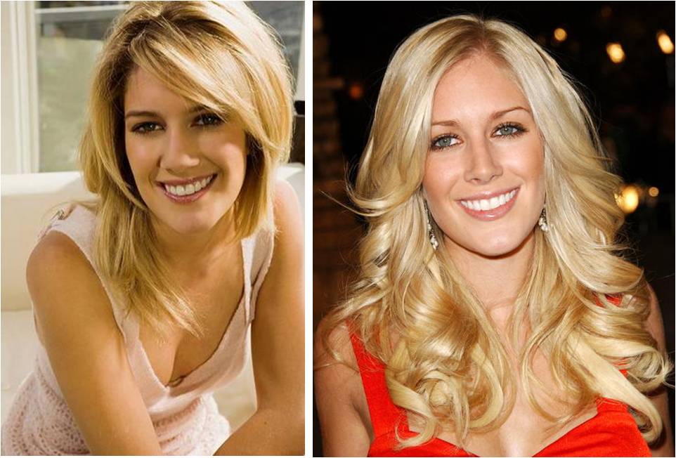 heidi montag before surgery. pictures Heidi Montag Before