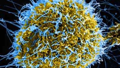 Virus Ebola Sangat Berbahaya Kepada Manusia