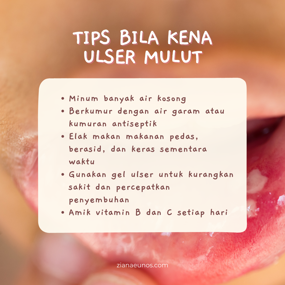 tips atasi ulser mulut